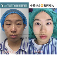 济南眼综合整形