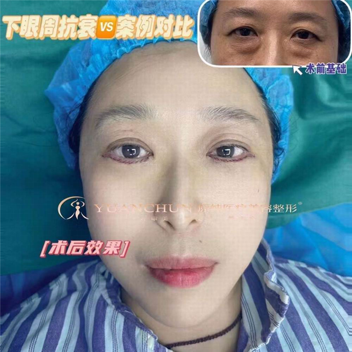 济南眼综合整形