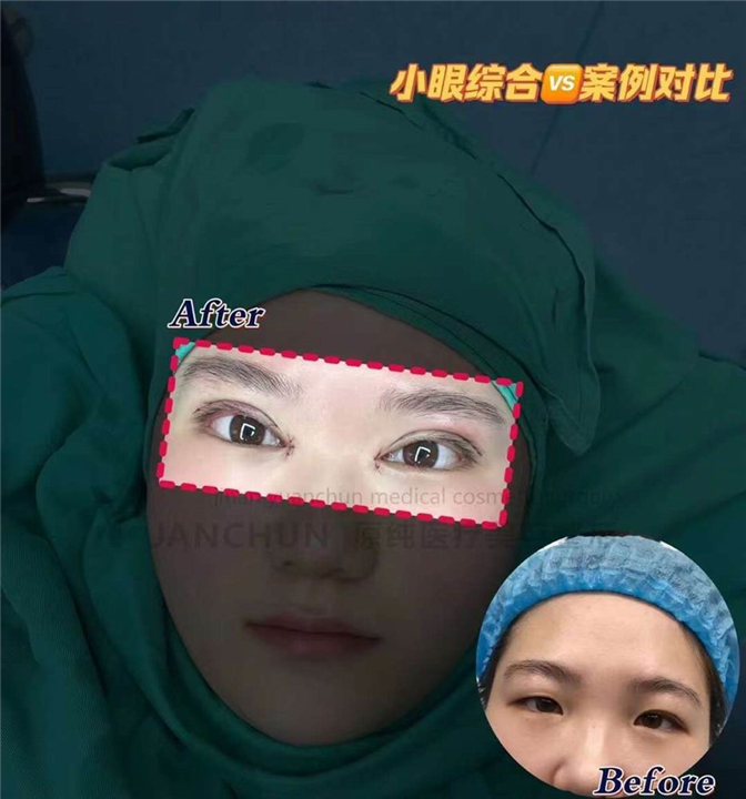 济南眼综合整形