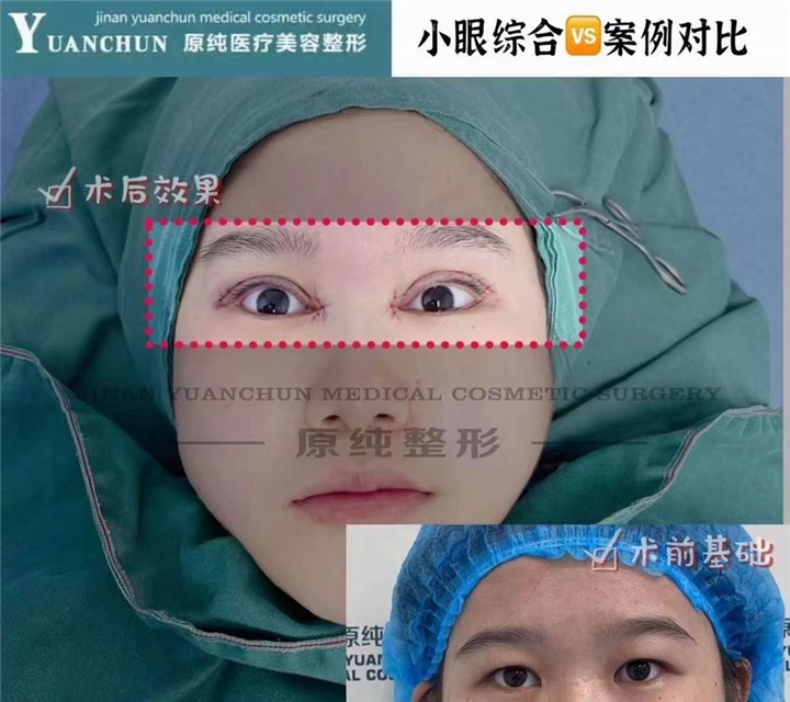 济南眼综合整形