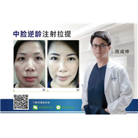 陈咸伸整形——中脸逆龄注射提拉 