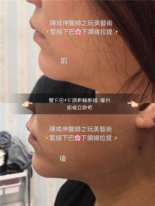 台湾鼻整形专家