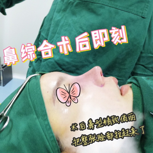 陈咸伸整形