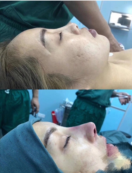 陈咸伸医生怎么样？