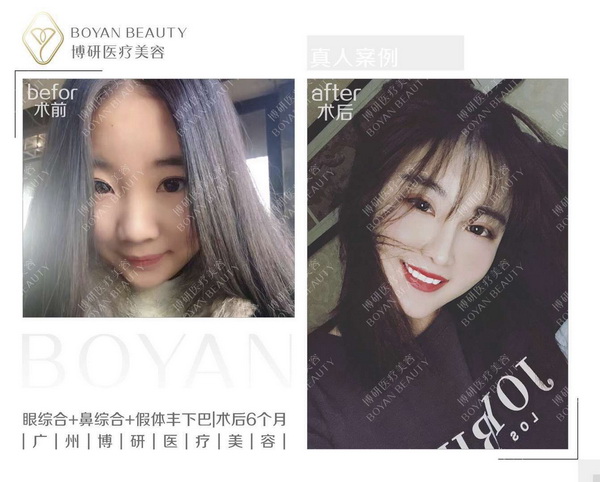 广州博研整形