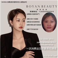 剥离微整哪里可以做