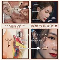 印第安纹韧带