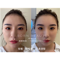 博恩汇美骨雕