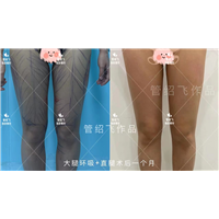 成都哪里可以做直腿术