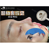 郑州超肋鼻综合整形