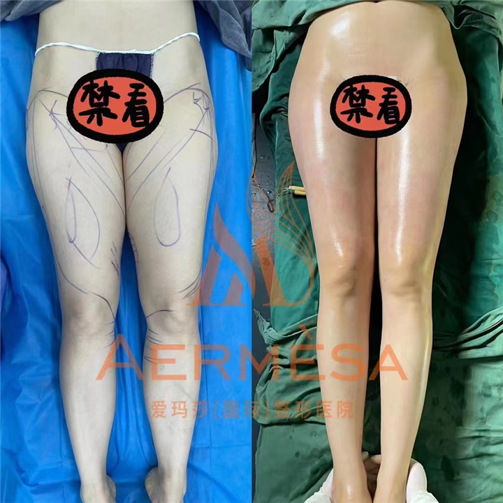 南宁爱玛莎院长王琪海