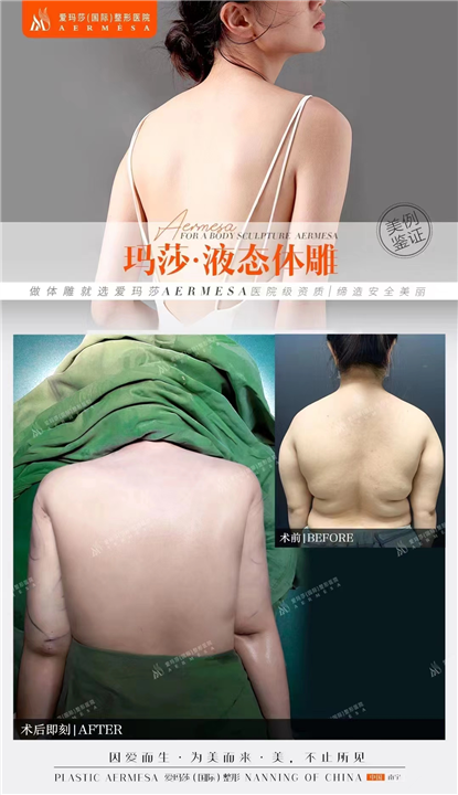南宁脂雕王琪海