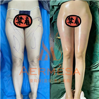 南宁爱玛莎院长王琪海