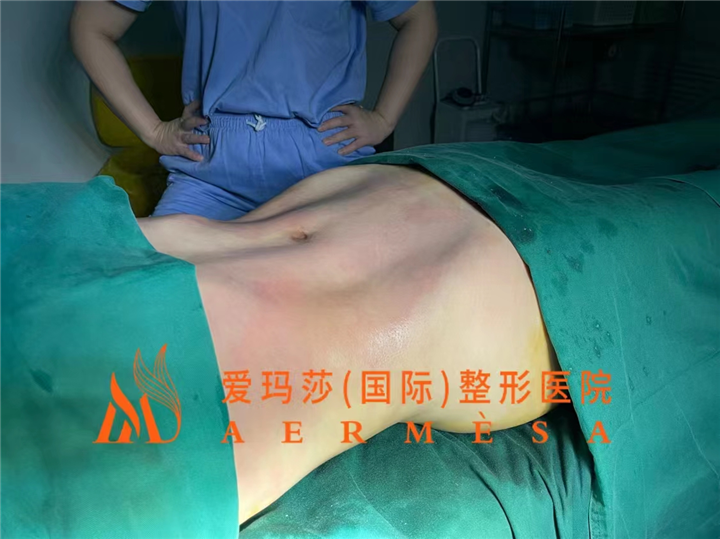 王琪海脂雕案例