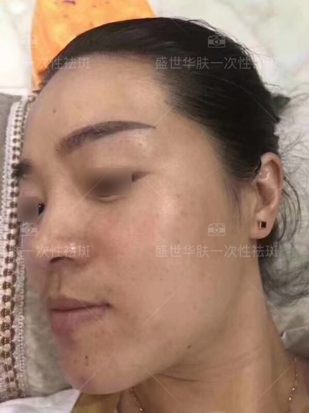盛世华肤问题性皮肤研究