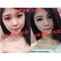 台湾哪个医生线雕做的好