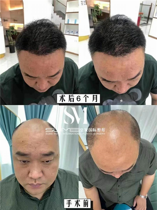 柬埔寨整形哪家好