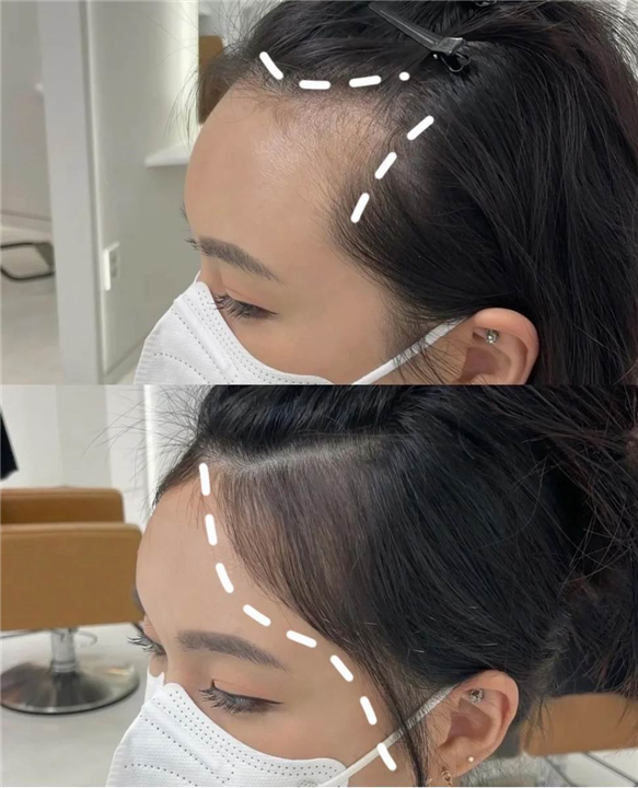 柬埔寨整形哪家好