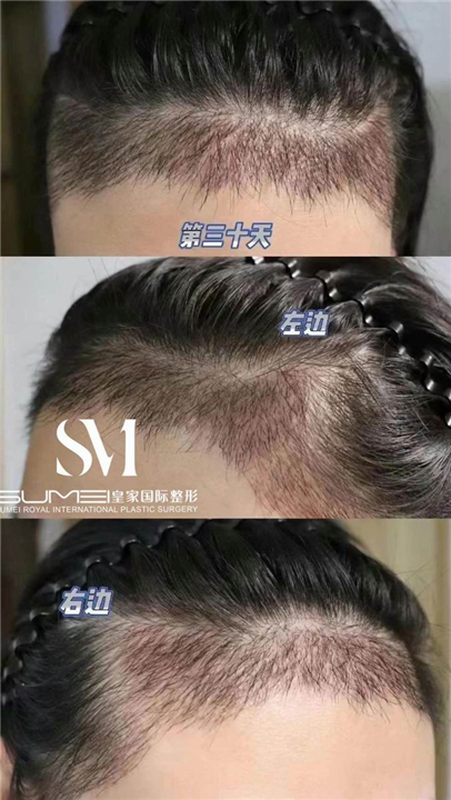 柬埔寨美容院哪家好