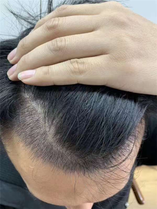 柬埔寨美容院哪家好