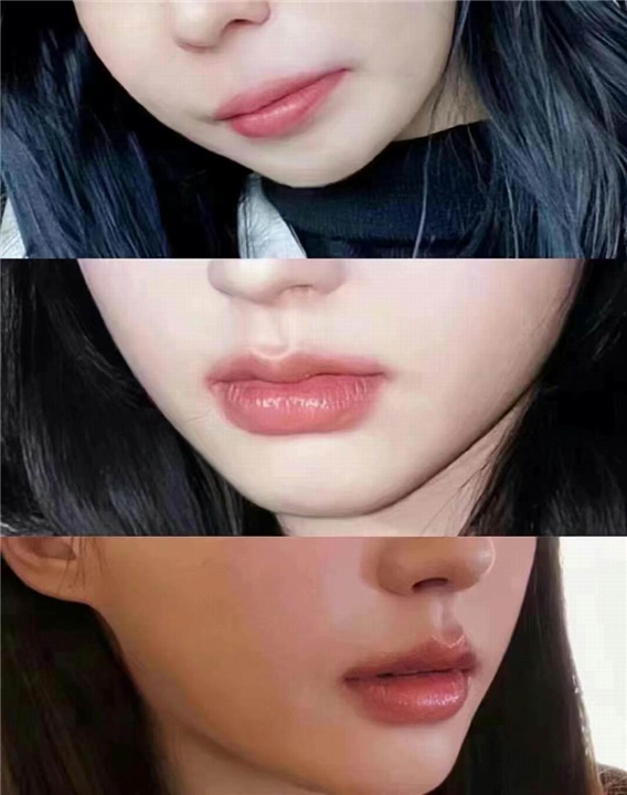 素美皇家整形医院