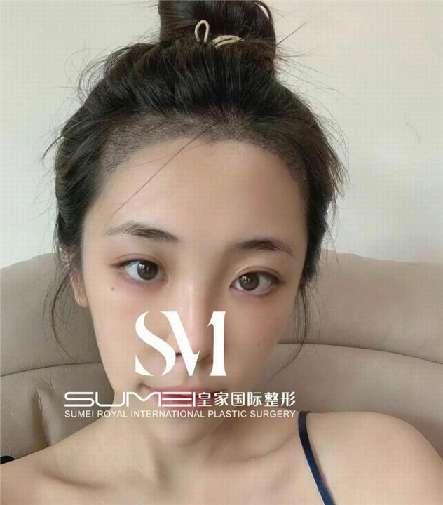 柬埔寨美容院哪家好