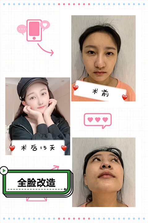 张晓建院长