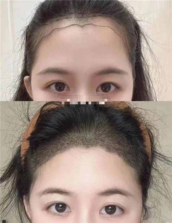 柬埔寨美容院哪家好