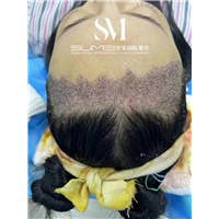 柬埔寨整形哪家好