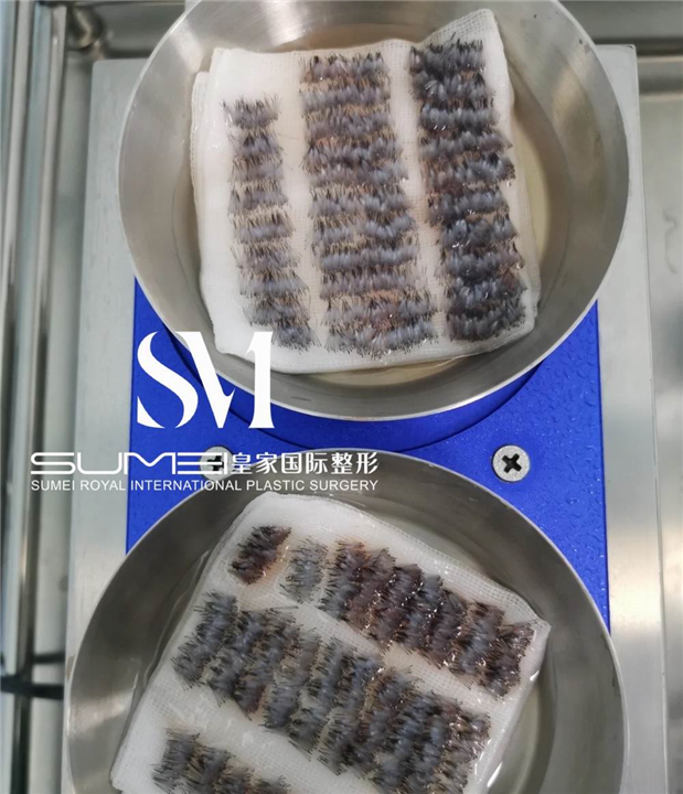柬埔寨美容院哪家好