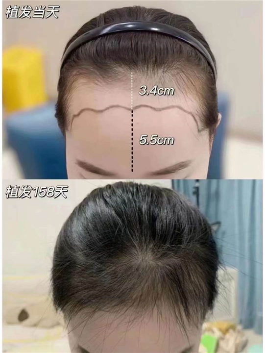 柬埔寨整形哪家好