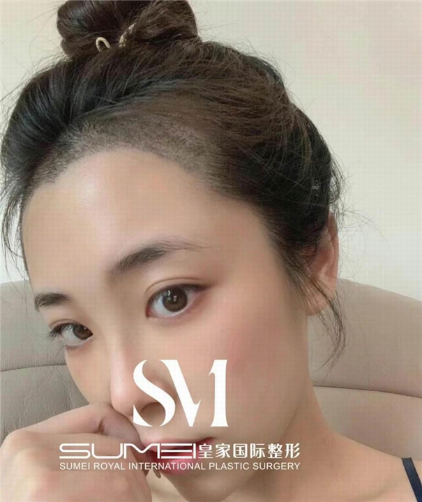 柬埔寨美容院哪家好