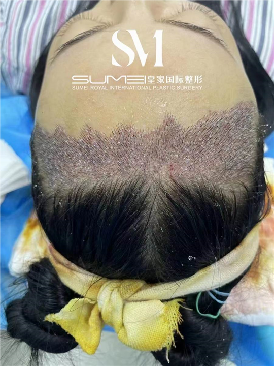 柬埔寨整形哪家好