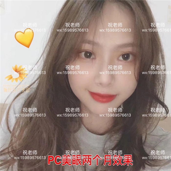 出现印第安纹怎么办？