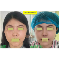 崔相平