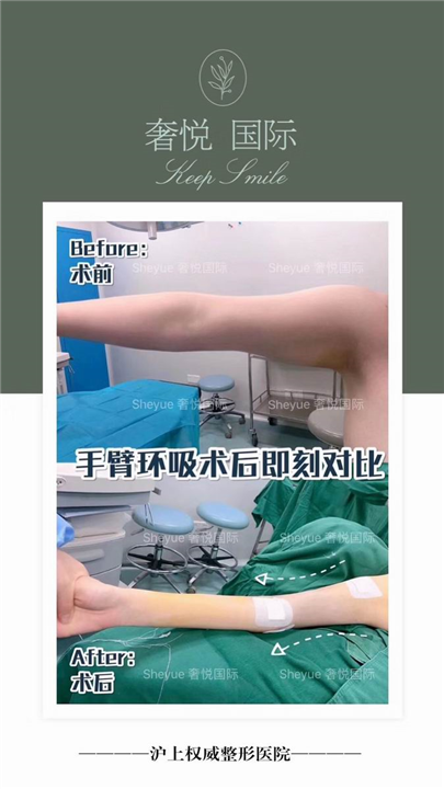 奢悦整形