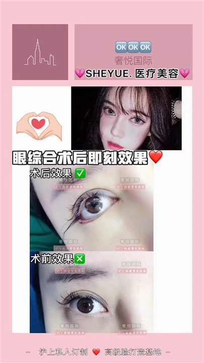 奢悦国际眼综合