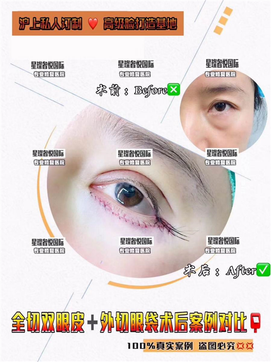奢悦国际眼综合