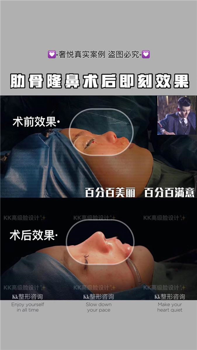 奢悦国际鼻综合