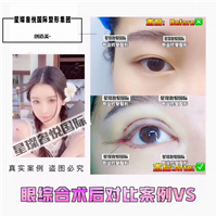 奢悦国际眼综合