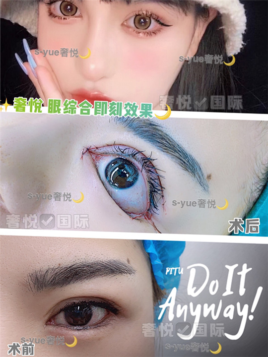 奢悦国际眼综合