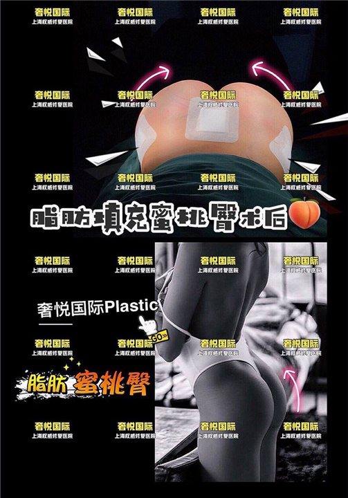 奢悦整形医院怎么样