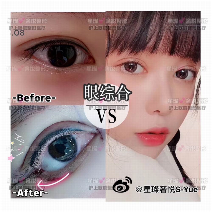 奢悦国际眼综合