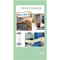 奢悦整形