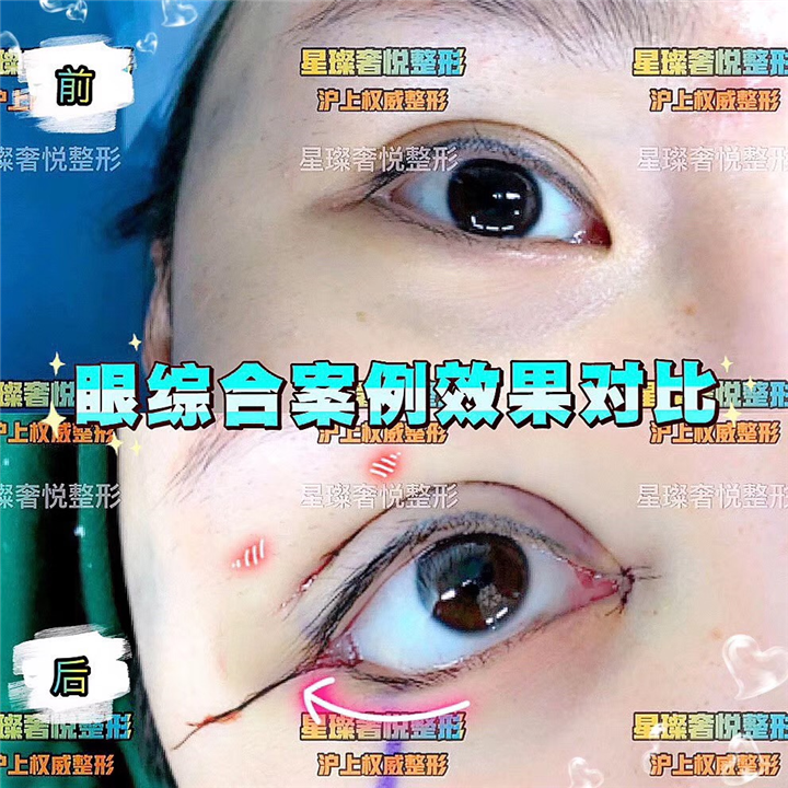 奢悦国际眼综合
