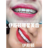 伊斯顿牙齿美白总部