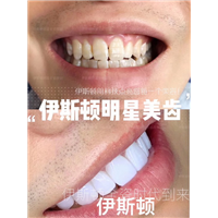 伊斯顿美牙
