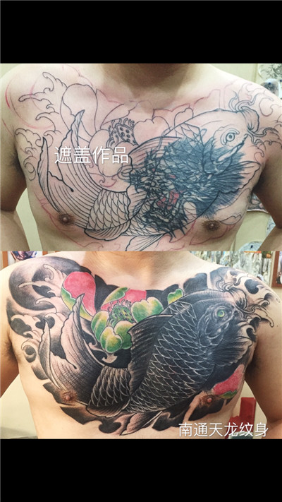 南通纹身哪家好_专业洗纹身 