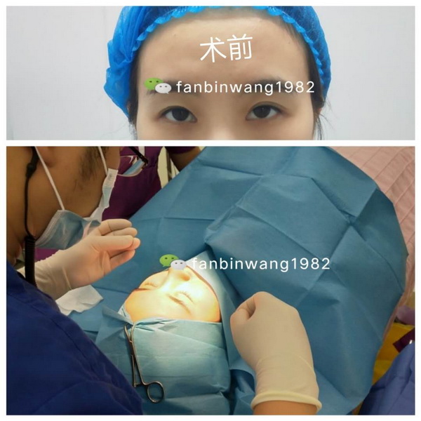 上海日式鼻综合