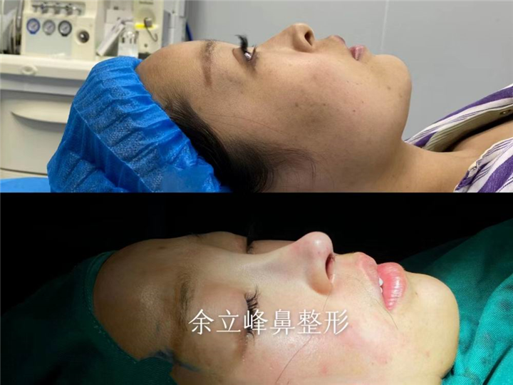 河南鼻整形修复医生